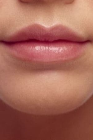 DUDAK KONTÜRLEME DOSYASI